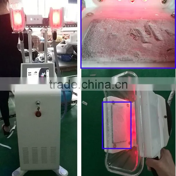 2015 Professional Vacuum Cryolipolysis Cool Sculpting Slimming Machine Flabby Skin photo-6