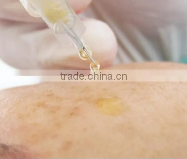 Platelet Rich Plasma PRP Tube photo-5