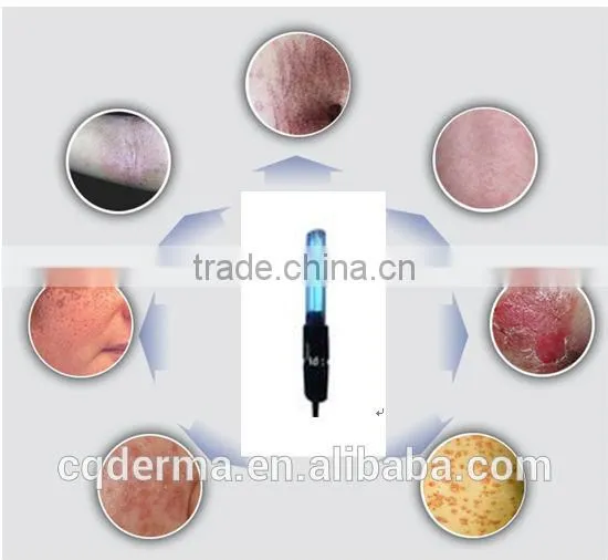 Home Use Portable UV Phototherapy 311nm Narrow Band Uvb Lamp for Psoriasis Treatment Vitiligo Treatment photo-5