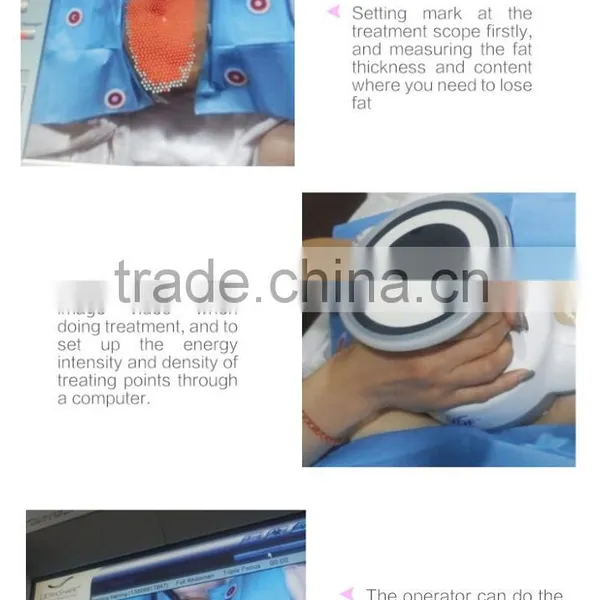 HIFU Ultrashape Body New 300W Slimming Technology Machine 7MHZ photo-5