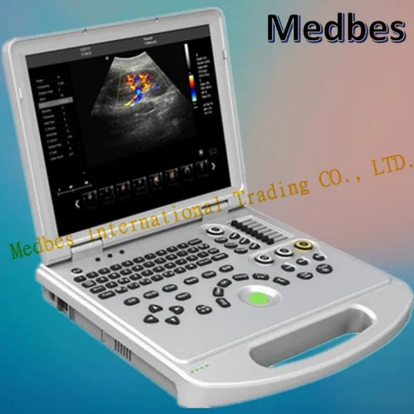 4D Color LAPTOP Ultrasound Diagnosis System photo-2