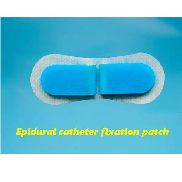 Epidural catheter fixation