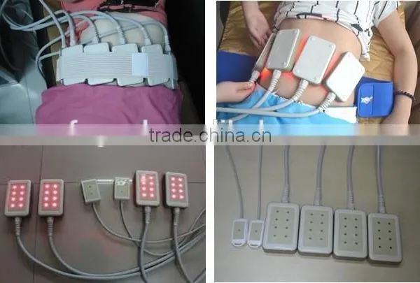 New Mini Diode Lipo Laser Slimming Weight Loss Machine Lipo Diode Laser Slimming Machine for Home Use photo-4