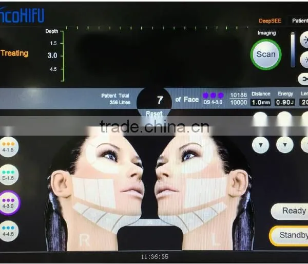 2016 High Intensity Focused Ultrasound Hifu/facelifting Hifu photo-5