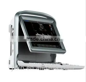 2016 NEW Ultrasound Scanner Color Doppler photo-5