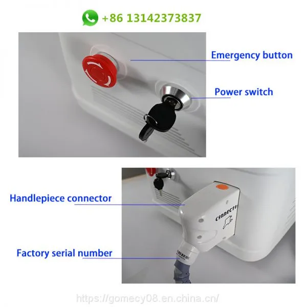 Portable Alma Laser Soprano Ice 755nm 808nm 1064nm Diode Laser Hair Reduction Equipment photo-5
