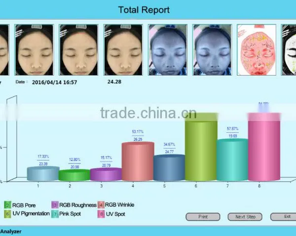 Quantum Analysis Machine/quantum Resonance Magnetic Skin Analyzer Machine photo-4