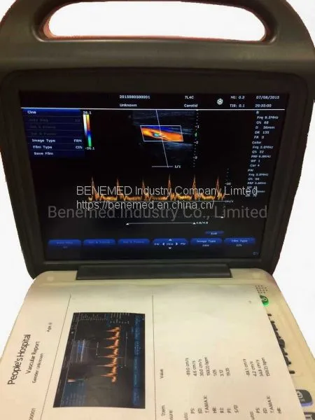 Popular Portable Color Doppler Ultrasound Scanner Bene-3 photo-3