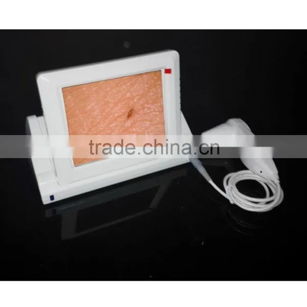 Hot in INDIA Skin and Hair Analyzer Machine photo-6