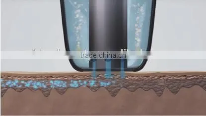 2016 Most Advanced Multifunction Microdermabrasion Water Jet Peeling Machine photo-3