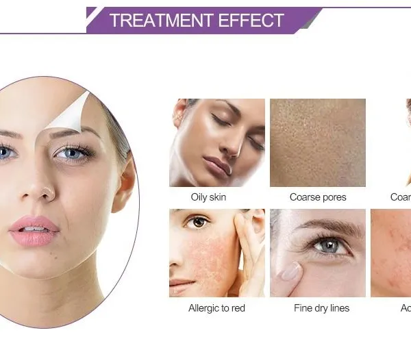 Hydro-oxygen Machine Spray Beauty Device With 5 Spray Modes for Skincare Spa photo-3