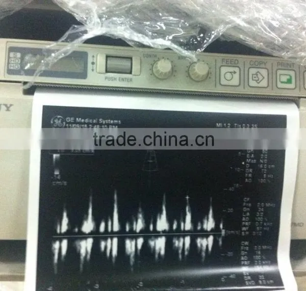 Sony Printing Paper UPS-110S for Ultrasound Printer photo-2