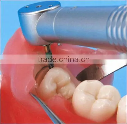 Oral Surgery Jaw Model photo-2