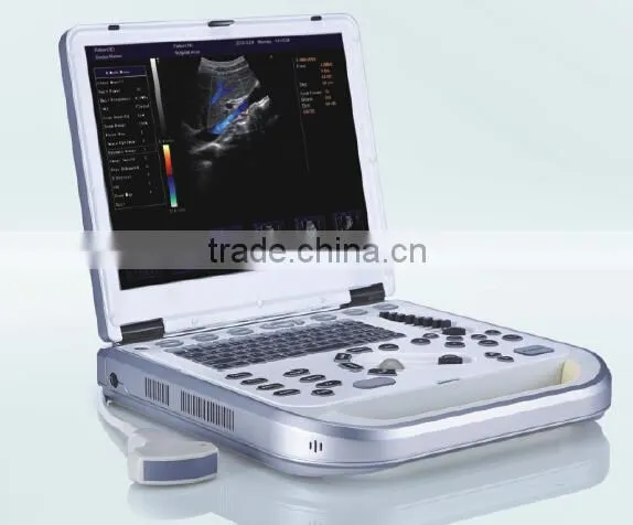 HY-M80 Laptop Color Doppler 2D