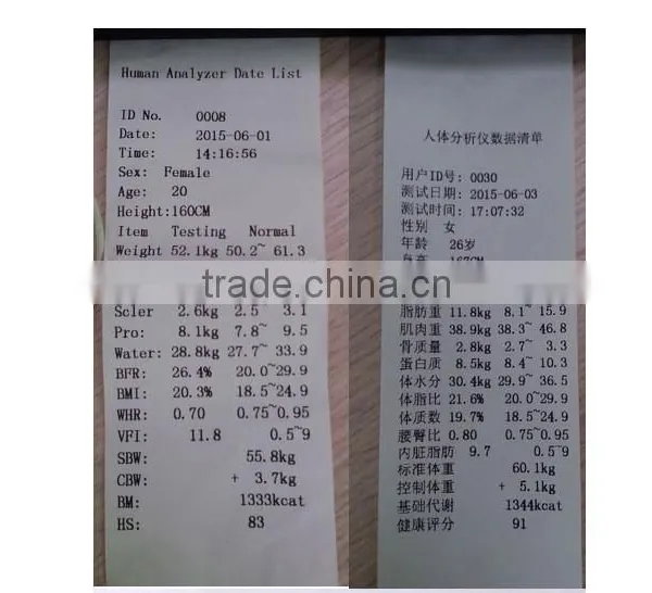 Professional Body Composition Analysis Machine/body Analyzer Machine photo-5