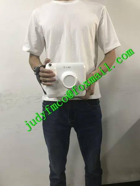 Remote Control Portable Dental X Ray Machine photo-4