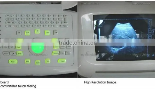 CE Approved Digital Portable Ultrasound Scanner With Multi Frequency Probe Machine photo-3
