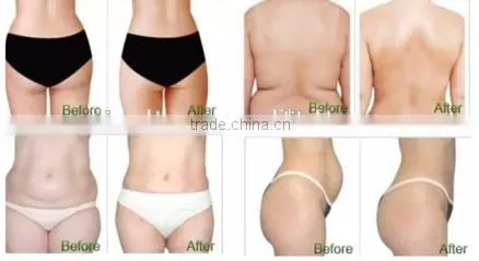 Body Slimming Body Shape Beauty Equipment photo-2