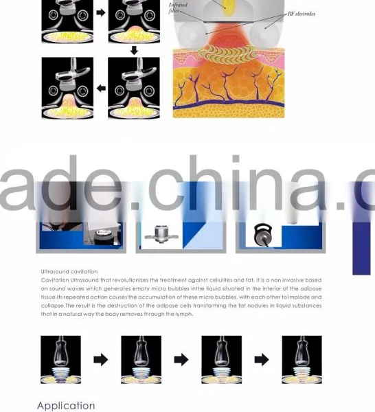 Osano Best Way To Lose Belly Fat Vacuum Suction Machine photo-6