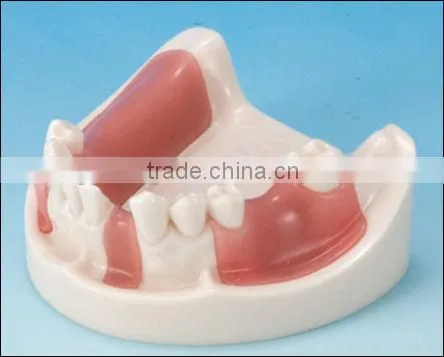 Dental Equipment Teaching Implant Tooth Model Standard Size Teeth Model photo-2