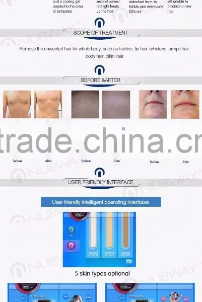 Germany Beauty Laser Equipment Permanent Alexandrite 808nm Diode Laser Body Hair Removal System for Hair Removal photo-6