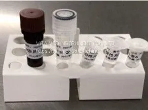 2019-Novel Coronavirus (2019-nCoV) RT-PCR Detection Kit Covid 19 Rapid Test Kit Wholesaler/distributor photo-2