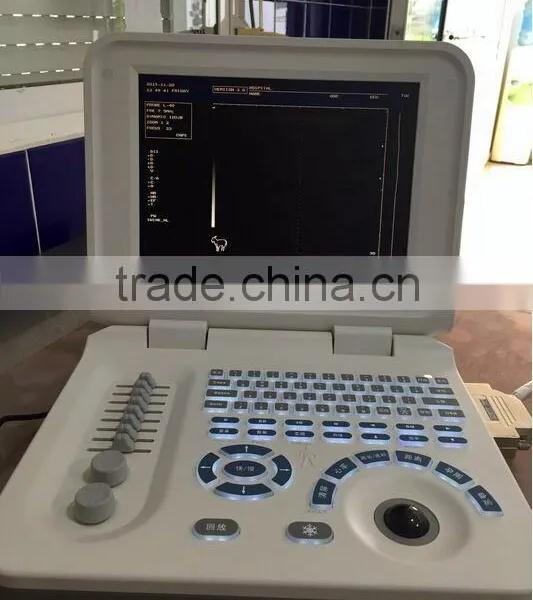 Laptop Ultrasound Scanner & Ultrasound Scanner For Horse