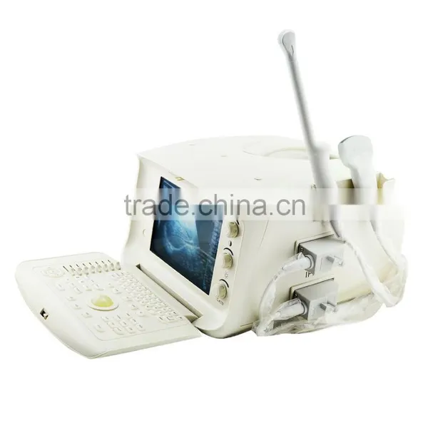 Carejoy Cheapest Portable Ultrasound Machine With Multi Frequency Probe SONY UP-898MD Video Thermal Recorder Optional photo-3