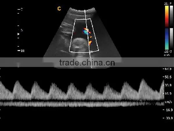 2016 New Portable Color Doppler(Optional 4D) for Cardiac Use photo-4