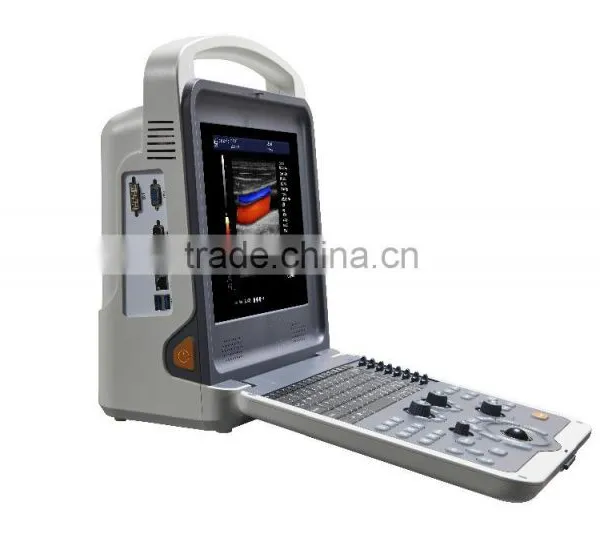 Digital Color Doppler 4D Ultrasound Machine K6 photo-3