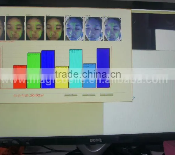 Big Discount!!!3d Scanner Dialysis Machine Price Dialysis Machine Price for Home Use photo-5