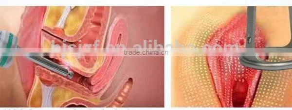 Treat Telangiectasis Three Heads In One System F7+ Sun Damage Recovery Beauty Machine From Anybeauty CO2 Fractional Laser Machine photo-5
