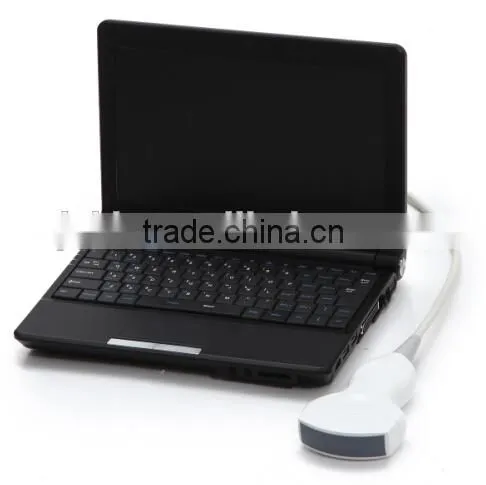 Handheld PC Platform 3D Workstation Ultrasound Scanner With Convex Linear Micro-convex Transvaginal Probe Optional photo-5