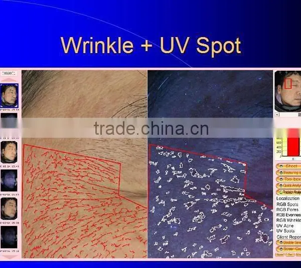 Ultrasonic Cleaner 3d Skin Analyzer photo-2