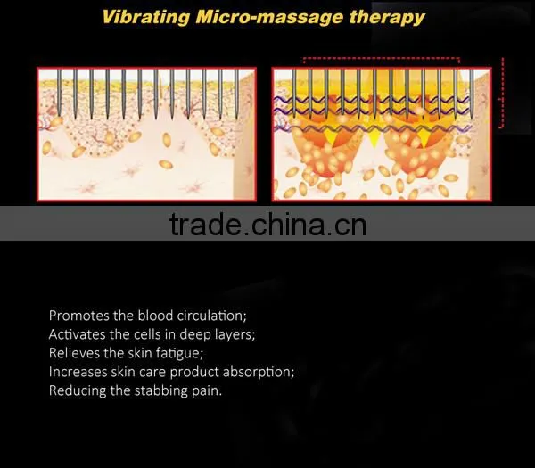 New LED 540 Needle Roller Acne Scars Cellulite Wrinkles Stretch Face Body Derma photo-6