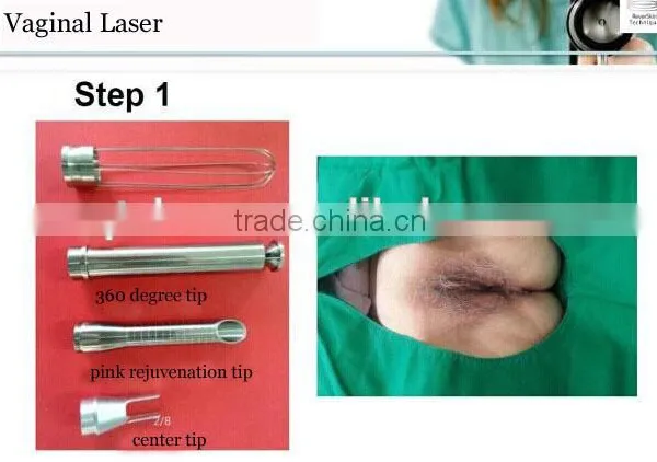 New 7 Joint Guiding Arm RF Tube Fractional Co2 Laser for Vaginal Treatment photo-4