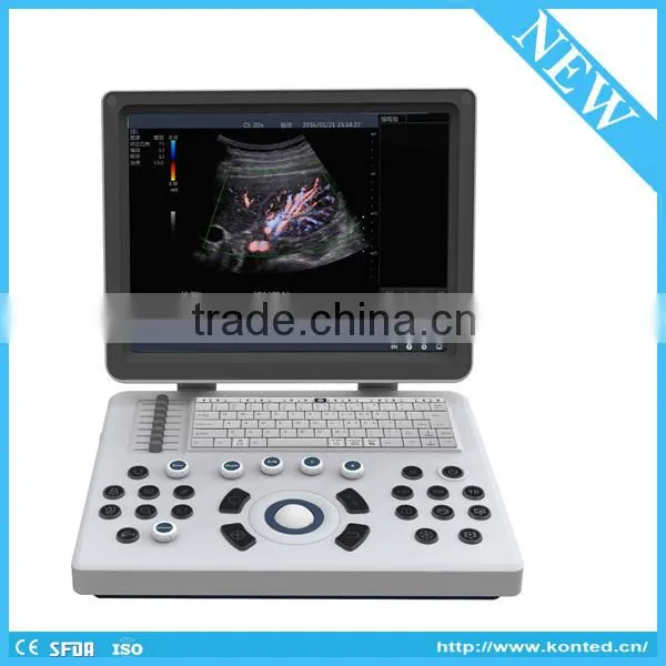 Multifunctional 4d Ultrasound With 128 Elements Electronic Probes Quality Choice photo-3