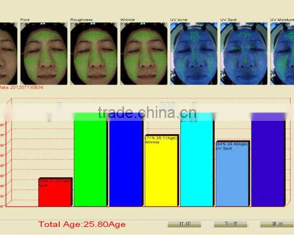 UV Light Skin Scope Face Skin Test Machine photo-4