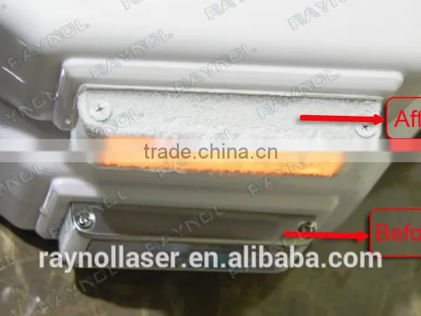 Best SSR and SHR Pore Remover IPL Beauty Machine photo-4