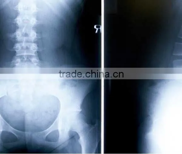 China Raio x da Coluna Lombar Film KND-A/F CE