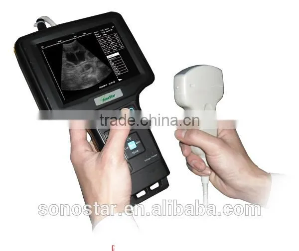 V6 Handle Ultrasound Scanner(ultrasonic,black White,Imaging photo-2