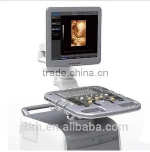 3D Trolley Ultrasound Scanner Color Doppler Ultrasound System (optional 4D) photo-2