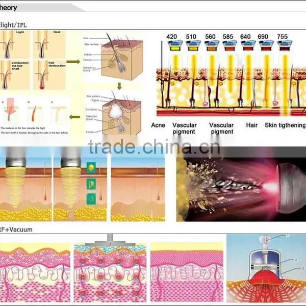 Hot Selling CE TUV 6 Handles Portable Elight Mini Ipl Laser for Age Spots photo-6