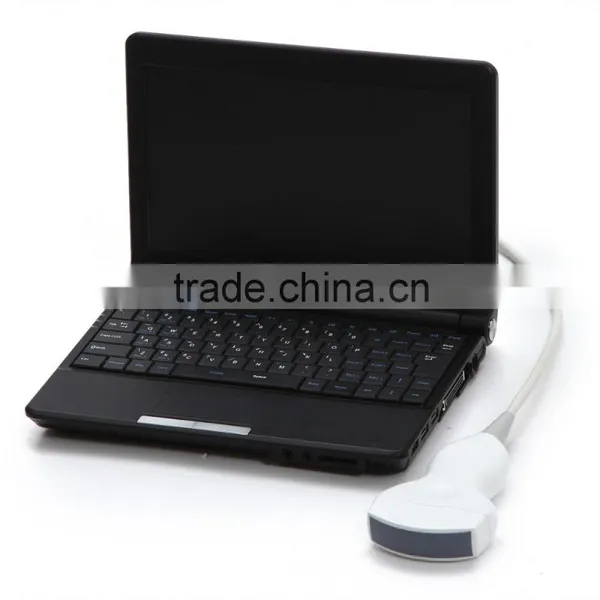 10 Inch Laptop Veterinary / Vet Ultrasound Scanner With 3.5MHz Convex Probe for Equine, Bovine, Swine, Sheep, Cat, Dog photo-2