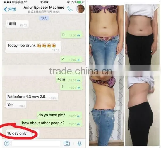 Double Chin Removal Beauty Tighten Cryolipolysis System Fat Freeze Fat Freezing Slimming Cryolipolysis Machine Increasing Muscle Tone photo-5