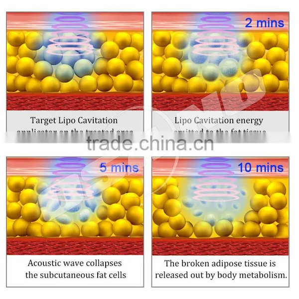 Super Slim Fat Freezing Cryolipolysis Zeltiq Machine With Cavitation Rf Laser Fat Melting photo-6
