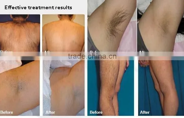 Ultrasonic Liposuction Cavitation Slimming Machine Vacuum+Cavitation+Bipolar RF+Nir+Roller Vertical 40hkz 5 In 1 Slimming Machine Slimming RF+ultrasonic Cavitation Machine Bipolar Rf Ultrasonic Liposuction Cavitation photo-4