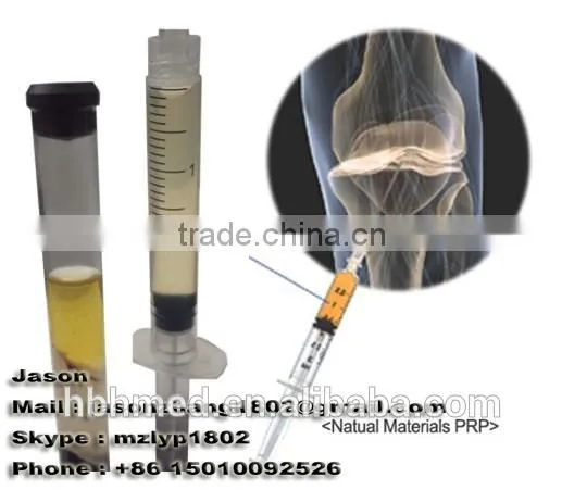 Platelet Rich Plasma Centrifuge Prp Kit photo-5