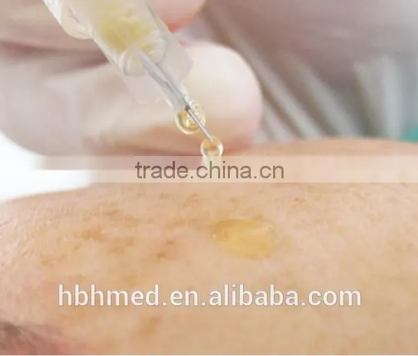 Non-pyrogenic Platelet Rich Plasma Prp Kit Easy photo-3