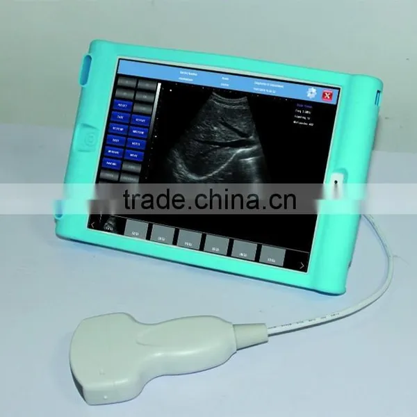 USB Probe B Ultrasound Scanner Integrates Ultrasound Scanner photo-2